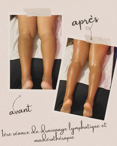 Photos avant/après